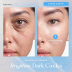 ♾️⚕️Celsiora® PDRN Anti-Wrinkle Shot – Lift & Firming Cream