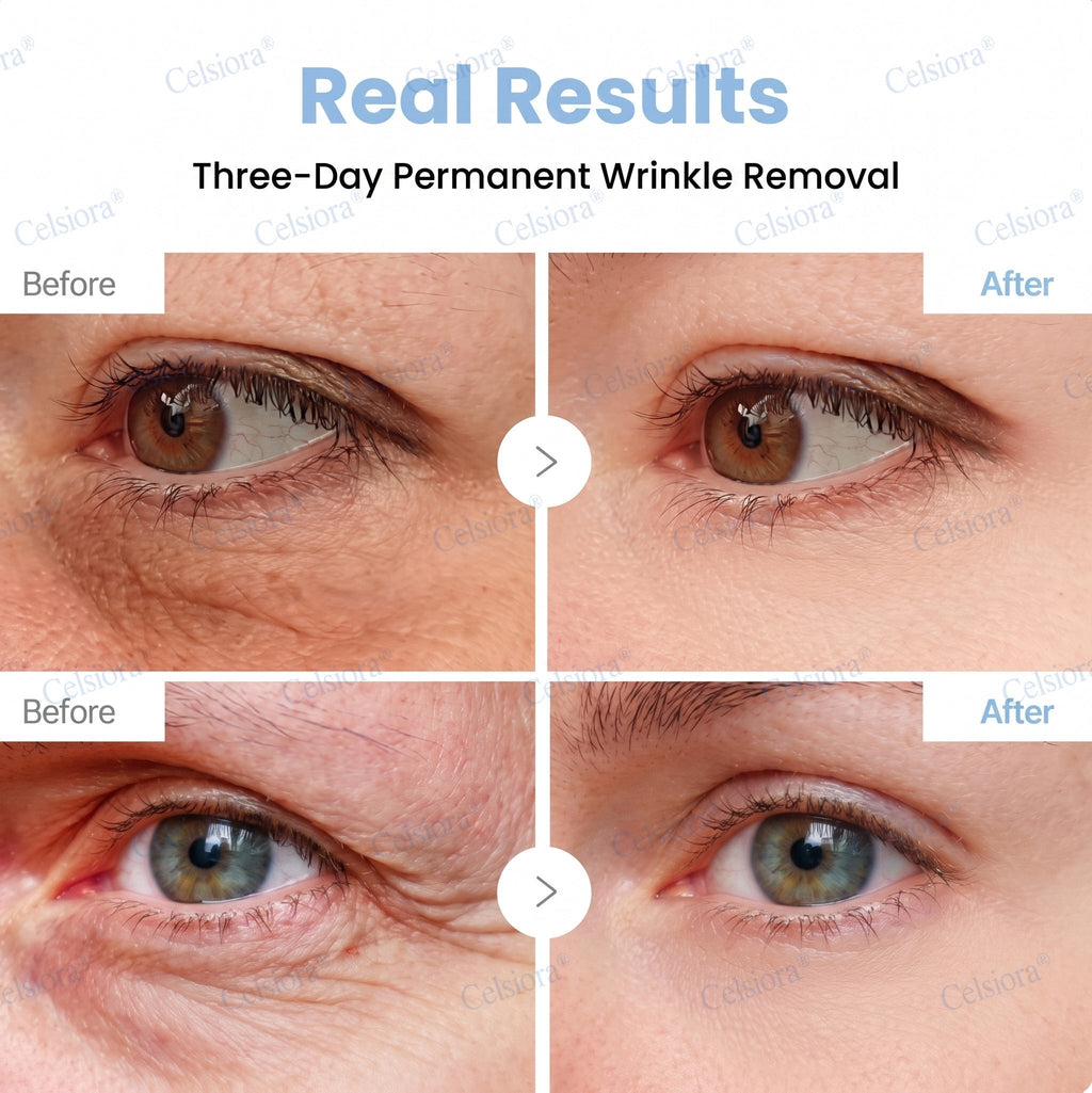 ♾️⚕️Celsiora® PDRN Anti-Wrinkle Shot – Lift & Firming Cream