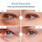 ♾️⚕️Celsiora® PDRN Anti-Wrinkle Shot – Lift & Firming Cream
