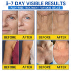 ♾️⚕️Celsiora® PDRN Anti-Wrinkle Shot – Lift & Firming Cream