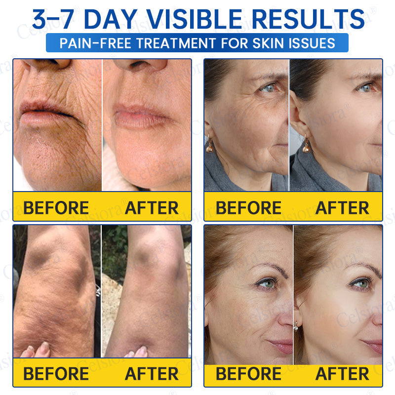 ♾️⚕️Celsiora® PDRN Anti-Wrinkle Shot – Lift & Firming Cream