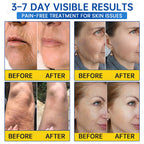 ♾️⚕️Celsiora® PDRN Anti-Wrinkle Shot – Lift & Firming Cream