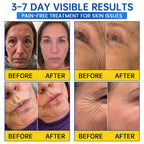 ♾️⚕️Celsiora® PDRN Anti-Wrinkle Shot – Lift & Firming Cream