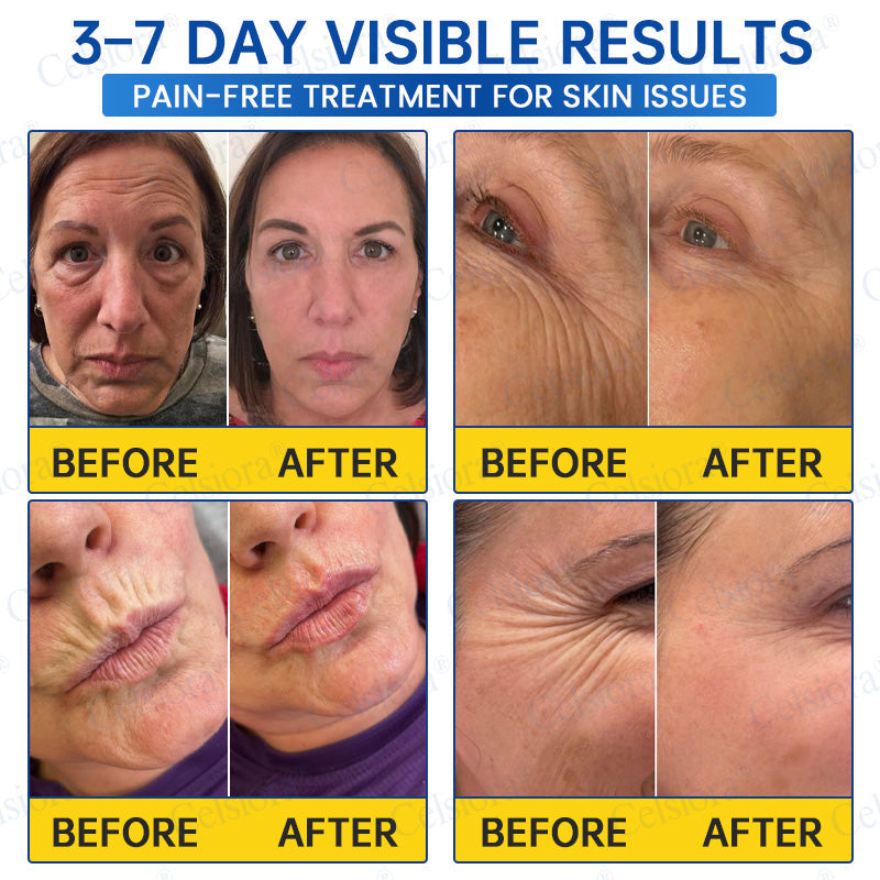 ♾️⚕️Celsiora® PDRN Anti-Wrinkle Shot – Lift & Firming Cream