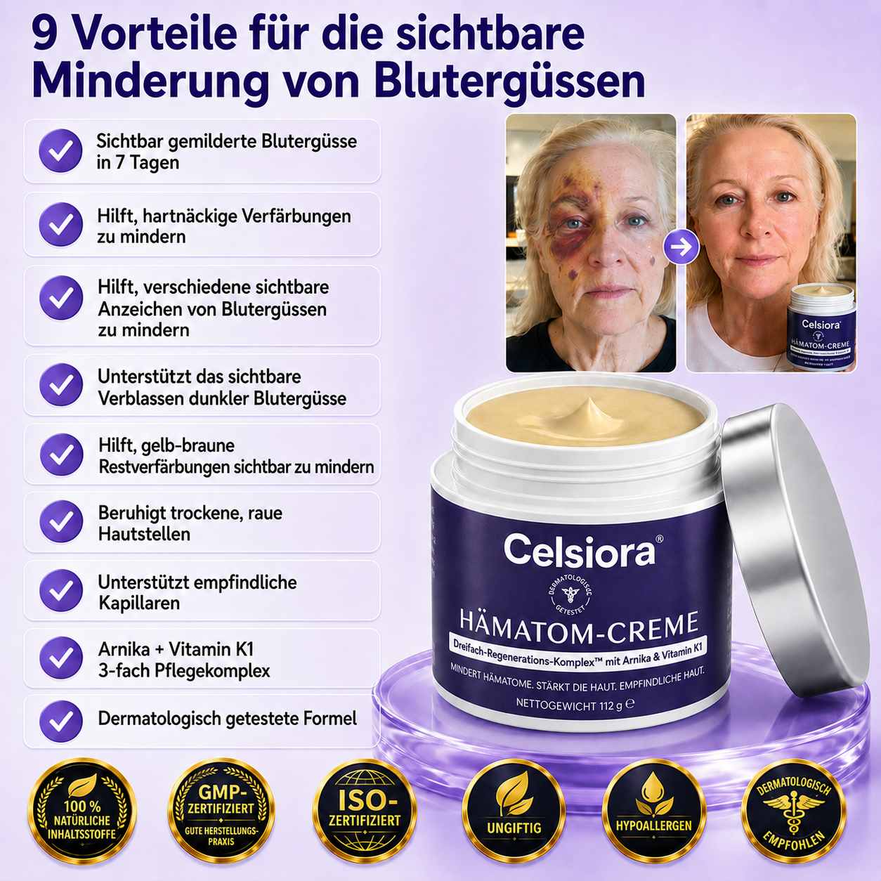 👩‍⚕️🌷 Celsiora® Intensiv-Pflegecreme für empfindliche, zu blauen Flecken neigende Haut