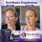 👩‍⚕️🌷 Celsiora® Intensiv-Pflegecreme für empfindliche, zu blauen Flecken neigende Haut